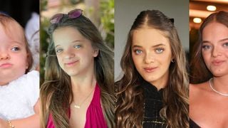 Antes e depois de Rafa Justus em 50 fotos: da infância à rinoplastia e ortognática, filha de Ticiane Pinheiro e Roberto Justus mudou MUITO e vai te impressionar