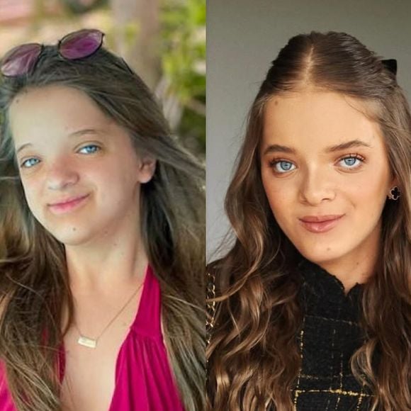 Antes e depois de Rafa Justus: veja 50 fotos da mudança da filha de Ticiane Pinheiro e Roberto Justus da infância à rinoplastia e ortognática