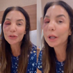 O que aconteceu com Ivete Sangalo? Cantora quebra dois ossos do rosto após desmaio, passa por cirurgia e surge inchada nas redes: ‘Estou bem’