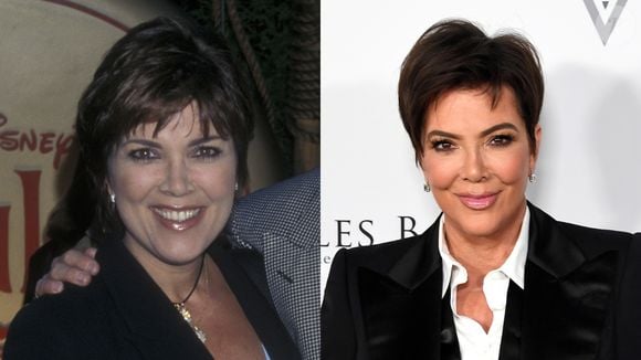 Kris Jenner, antes do lifting super comentado, apostava no botox e as maçãs avantajadas no rosto são a prova