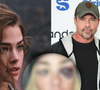 Estrela de '007', Denise Richards expõe fotos do rosto após ser espancada em episódio de paranóia do ex-marido: 'Me estrangulava'