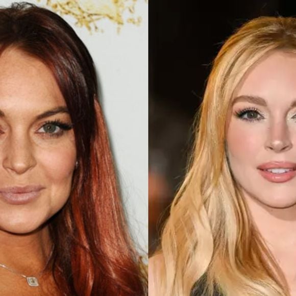 Antes e depois de Lindsay Lohan: embora não tenha revelado, atriz supostamente fez um facelift para ficar com o rosto rejuvenescido