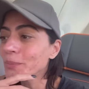 Carol Castro, no ar em 'Garota do Momento', expôs nas redes sociais que sofre com a situação da rosácea.