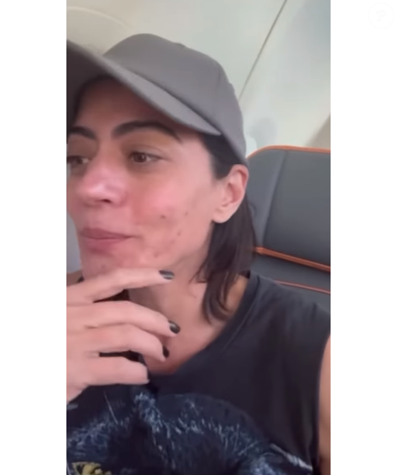 Carol Castro, no ar em 'Garota do Momento', expôs nas redes sociais que sofre com a situação da rosácea.