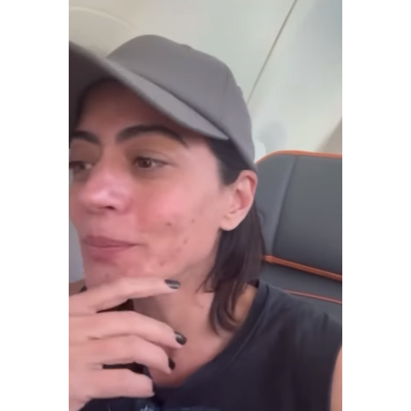 Carol Castro, no ar em 'Garota do Momento', expôs nas redes sociais que sofre com a situação da rosácea.