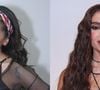 Antes e depois de Anitta: cantora transformou sua aparência através de procedimentos estéticos e muitas cirurgias plásticas