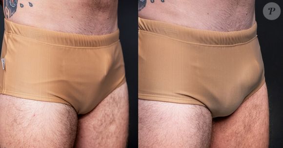 Ex-’BBB’ Wagner Santiago mostrou antes e depois da harmonização íntima na web