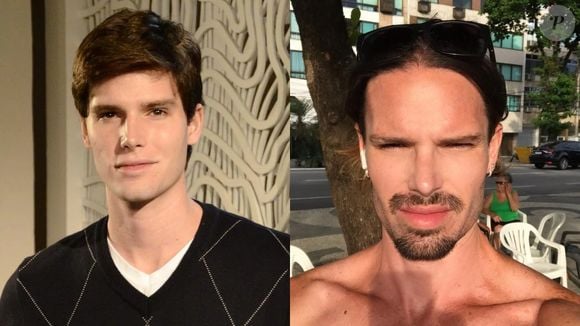 Antes e depois de Jonatas Faro: desaparecido da TV, o ator mudou muito sua aparência nos últimos anos, e a harmonização facial ajudou nisso