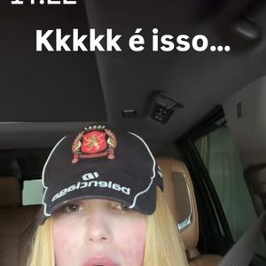 Rosto avermelhado e reação intensa: Virgínia Fonseca esclarece estado da pele após protocolo estético realizado antes do fim de ano