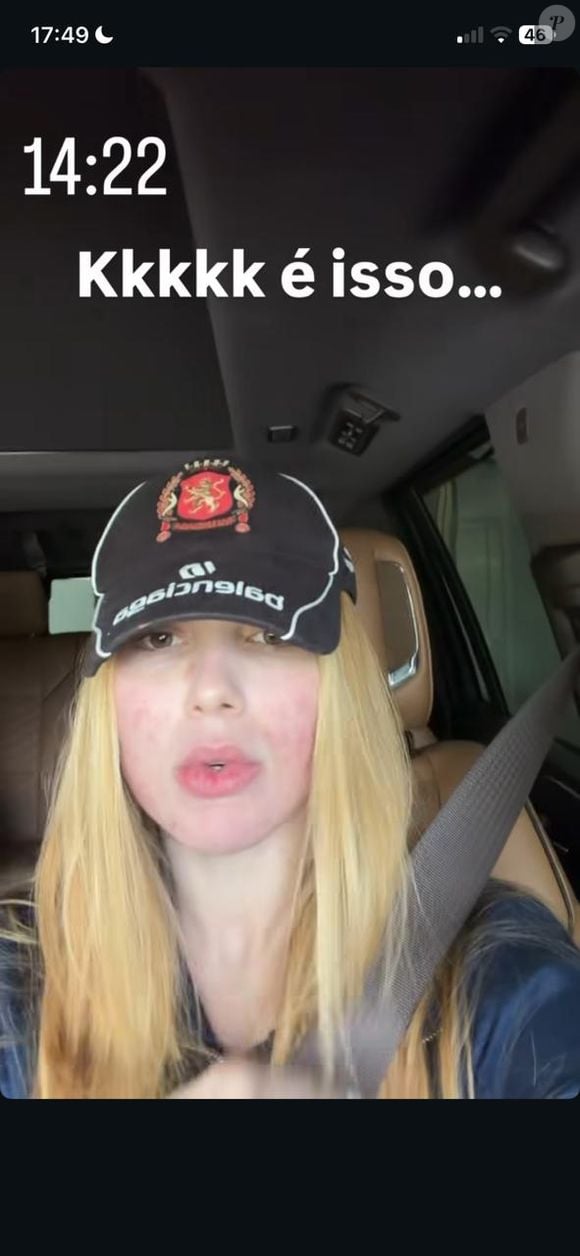 Rosto avermelhado e reação intensa: Virgínia Fonseca esclarece estado da pele após protocolo estético realizado antes do fim de ano