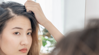 Chega de caspa! Este é o produto perfeito para se livrar da dermatite seborreica e parar de passar perrengue com seu cabelo