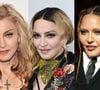 Antes e depois de Madonna em 50 fotos: lifting, rinoplastia e preenchimento estão na lista de intervenções suspeitas entre fãs e especialistas