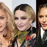 Antes e depois de Madonna em 40 fotos: lifting, rinoplastia e preenchimento estão na lista de intervenções suspeitas entre fãs e especialistas