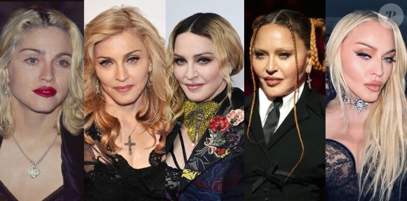 Antes e depois de Madonna em 50 fotos: lifting, rinoplastia e preenchimento estão na lista de intervenções suspeitas entre fãs e especialistas