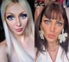 Barbie Humana antes e depois: veja a transformação de Bárbara Jankavski, que fez 27 cirurgias antes de morrer