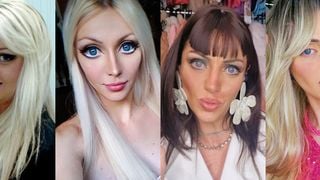 Barbie Humana antes e depois: morta aos 31 anos, Bárbara Jankavski fez 27 cirurgias e ficou completamente irreconhecível; veja 40 fotos!