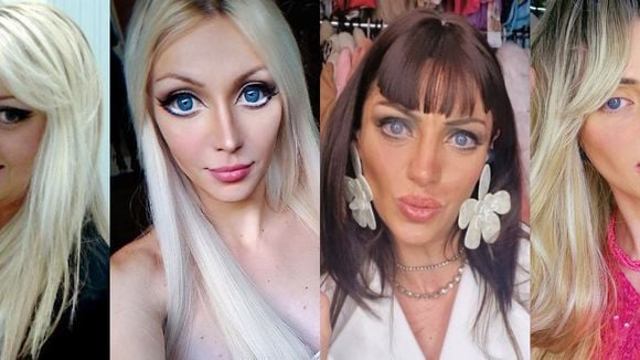 Barbie Humana antes e depois: morta aos 31 anos, Bárbara Jankavski fez 27 cirurgias e ficou completamente irreconhecível; veja 40 fotos!