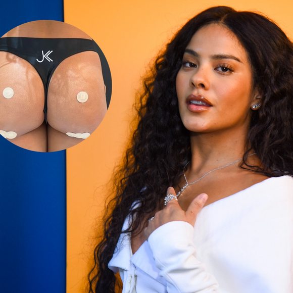 Bella Campos 'turbina' o bumbum e faz tratamento para 'corrigir' hip dips de forma natural após fim de 'Vale Tudo'. Veja antes e depois!