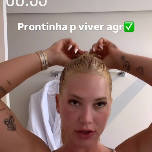 Aos 27 anos, Virginia Fonseca explicou o motivo do inchaço no rosto após procedimento estético
