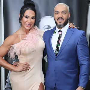 Belo nunca comentou sobre procedimentos estéticos no rosto, mas tudo indica que ele já tenha feito