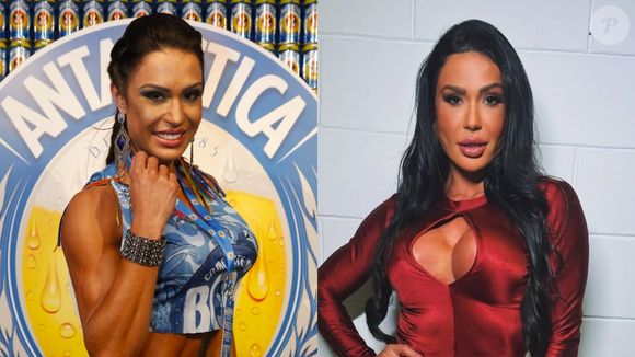 Antes e depois de Gracyanne Barbosa: musa fitness não esconde suas mudanças no rosto e chegou a se arrepender, desfazendo parcialmente a harmonização