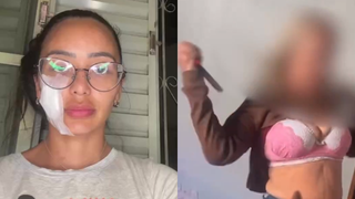 Ex-bailarina do Faustão esfaqueada pela mãe expõe vulnerabilidade financeira e diz que também foi agredida pelo irmão: ‘Preso em flagrante’