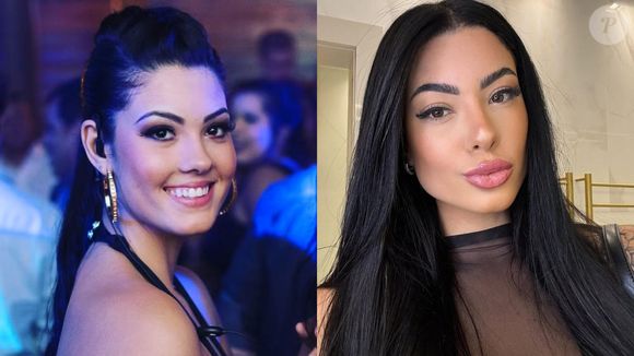 Após muitos questionamentos, a affair de Belo revelou enfim quais procedimentos estéticos já fez