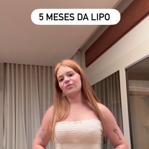 5 meses após as cirurgias, Viih Tube mostrou como ficou o resultado