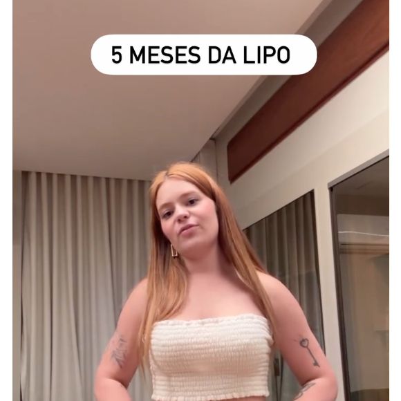 5 meses após as cirurgias, Viih Tube mostrou como ficou o resultado