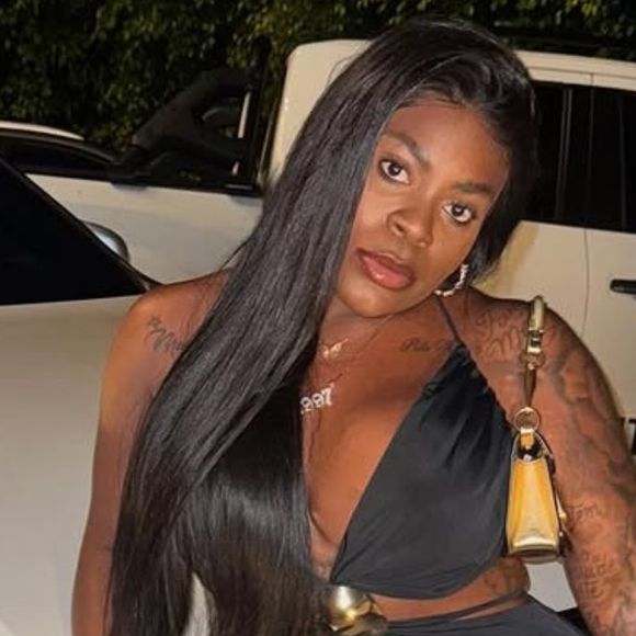 Jojo Todynho vive drama após fazer novas cirugias plásticas e revela crise de choro