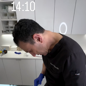 Quem realizou o procedimento em Gkay foi o dermatologista Dr. Simon Ourian, conhecido por trabalhar com famosas como Kim Kardashian e Lady Gaga