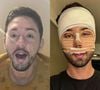 Antes e depois de Rico Melquiades: 40 fotos mostram mudança radical do influenciador com procedimentos estéticos