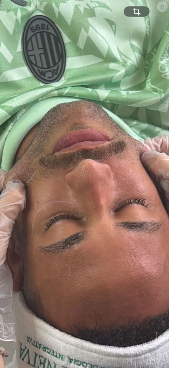 Segundo a Dra. Juliana Neiva, "o tratamento é voltado principalmente para combater a flacidez, estimular a produção de colágeno e melhorar a firmeza e o contorno da pele, sem cirurgia"