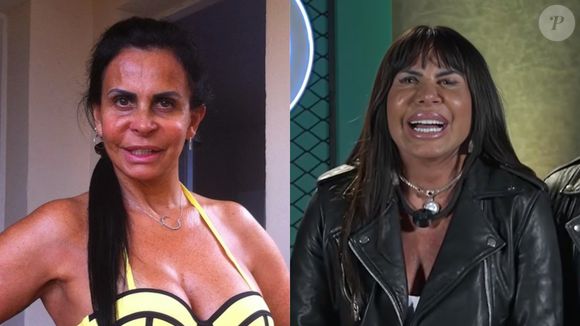 Antes e depois de Gretchen: procedimentos estéticos deixaram a cantora irreconhecível, mas ela voltou atrás e desfez alguns deles