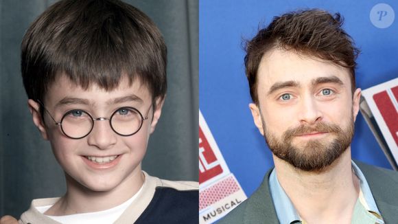 Antes e depois de Daniel Radcliffe: eterno Harry Potter, o galã mudou bastante, mas ainda carrega os olhinhos do seu personagem marcante