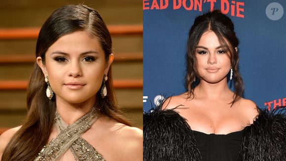 Antes e depois de Selena Gomez: natural, atriz e cantora preza por uma beleza mais sutil, sem procedimentos invasivos