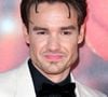 Liam Payne sofreu múltiplos traumas que levaram a hemorragias internas e externas.