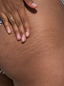 Carmen Martín, especialista em dermocosmética: 'O creme Nivea da lata azul reduz o risco de surgirem novas estrias, pois proporciona uma nutrição extra que aumenta a elasticidade da pele'