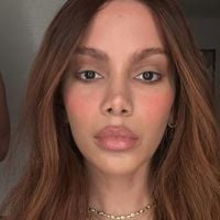 Exagerou? Após rosto 'irreconhecível' de Anitta viralizar, especialista alerta para riscos de procedimentos estéticos antes dos 35