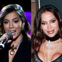 Antes e depois de Anitta: diferente mais uma vez, cantora já mudou de rosto muitas vezes com plásticas e essas 30 fotos são a prova disso