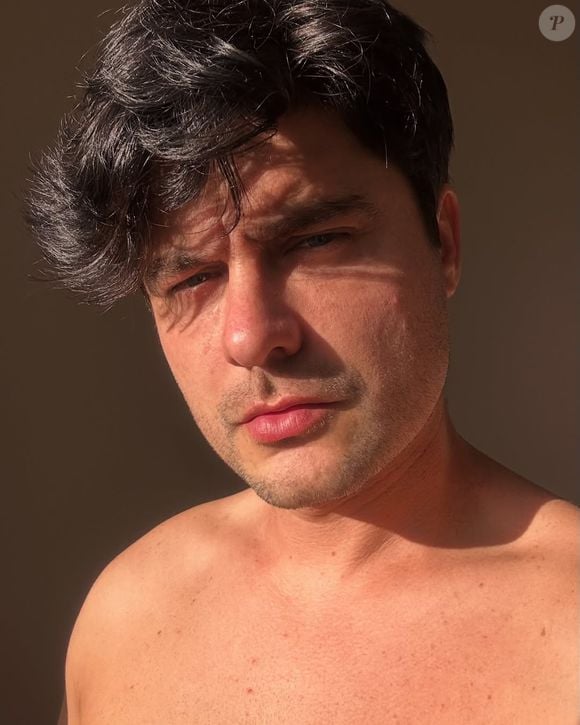 Guilherme Leicam fez preenchimentos na mandíbula, malar, nariz, orelhas, queixo e têmpora, além de ter aplicado toxina botulínica em todo o rosto