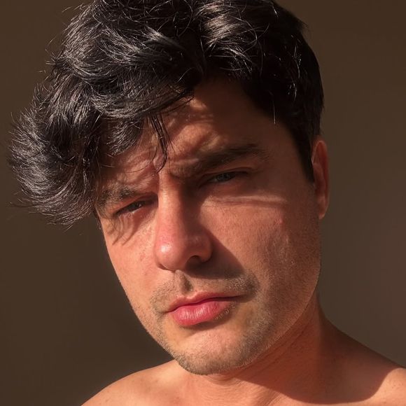 Guilherme Leicam fez preenchimentos na mandíbula, malar, nariz, orelhas, queixo e têmpora, além de ter aplicado toxina botulínica em todo o rosto