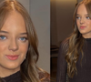 Cinto-saia com couro de vaca: após segunda rinoplastia, Rafaella Justus dá toque fashionista a look basiquinho com acessório de R$ 439. Fotos!