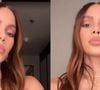 Antes e depois de Anitta: nos últimos dias, cantora apareceu com o visual renovado na web