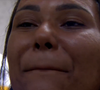 A fala de Chaiany repercute por representar uma insegurança comum entre mulheres com lábios pequenos