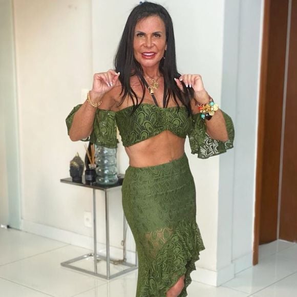 Maxilares e queixo de Gretchen ganharam novos contornos com os procedimentos estéticos