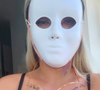Em entrevista, Andressa Urach revelou que alterou o formato dos seus olhos e reduziu o tamanho de suas orelhas