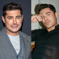 Zac Efron voltou a ser bonito? 20 fotos do antes e depois do ator após supostos procedimentos no rosto