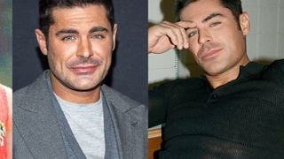 Zac Efron voltou a ser bonito? 20 fotos do antes e depois do ator após supostos procedimentos no rosto