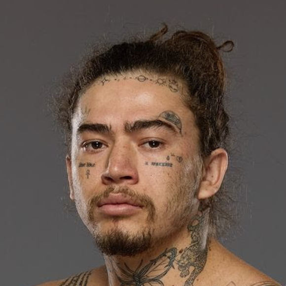 Whindersson Nunes teve alta da clínica em março deste ano.